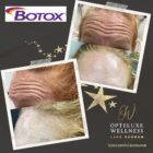 Social Media Basic 5 Reduce Acne Scarring Tighten The Skin Build Collagen Leaves A Glowing Appearance 2 - The Real Social Company